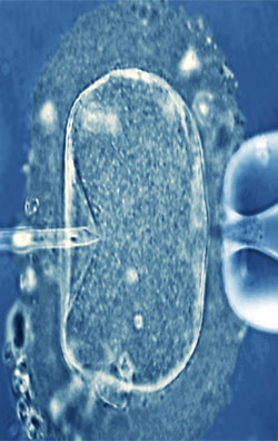 In-vitro-fertilization