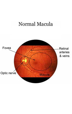 Macular Degeneration, its Symptoms and Treatment