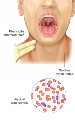 health articles