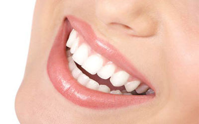 bright white teeth