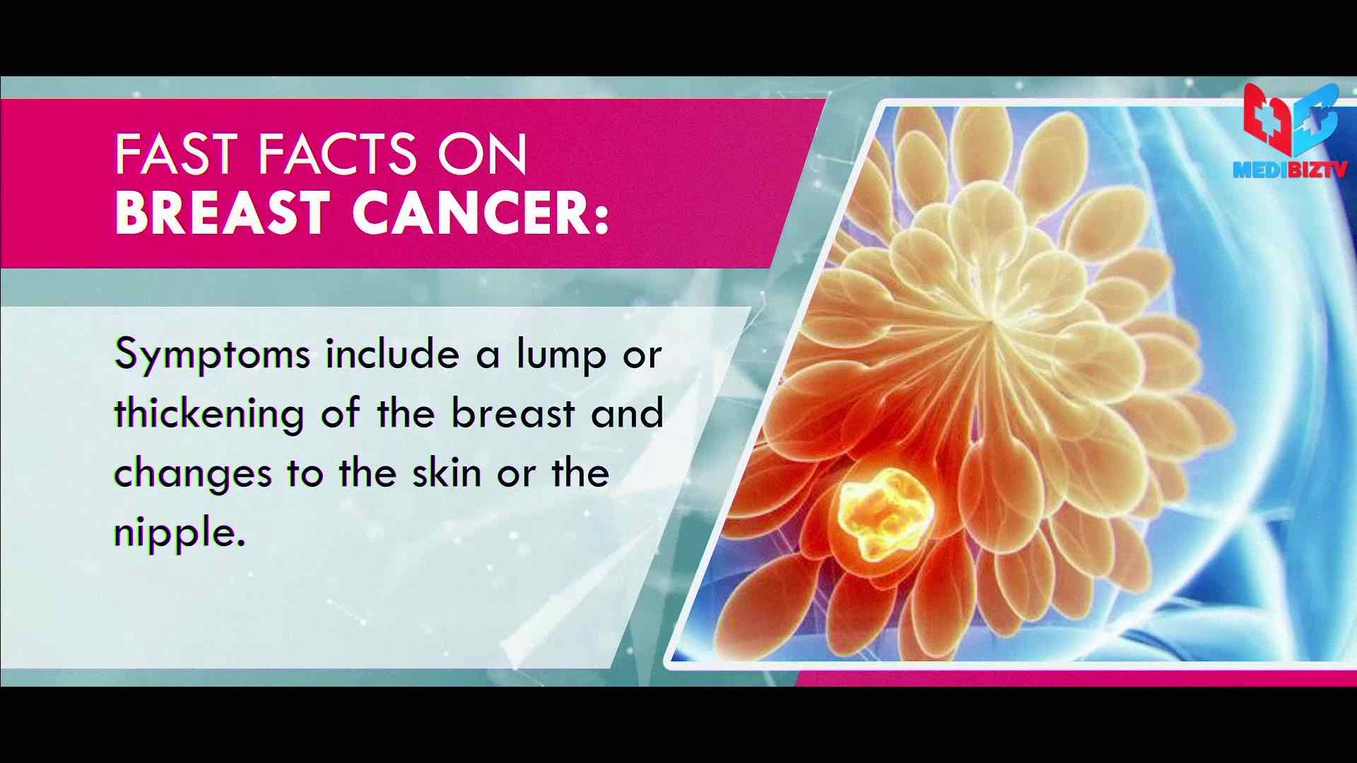 Fast Facts on Breast Cancer
